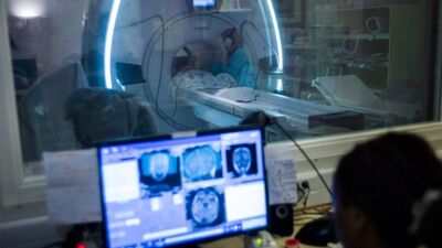 Elektronörofizyoloji Bölümü Nedir?