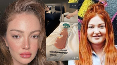 "Kalçamdan çıkan dolgu"