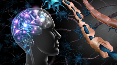 İşte MS'in az bilinen belirtileri