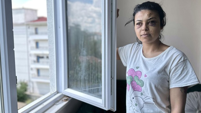 Sokak düğününde maganda ateşi! Saçmalar gözüne isabet etti!