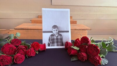 Bisiklet sürerken başına yorgun mermi isabet etti!