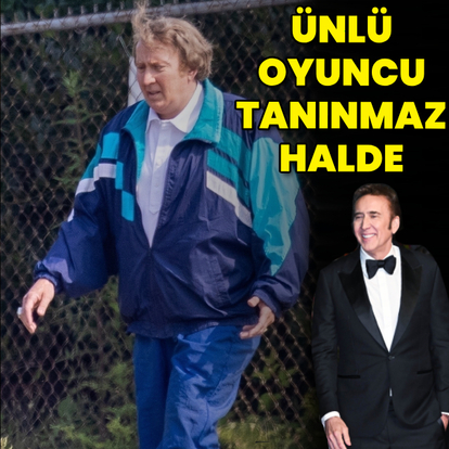 Ünlü oyuncu tanınmaz halde