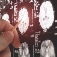 Parkinson'u tespit eden kalem üretildi