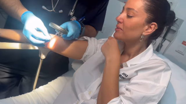 Koluna kene yapıştı