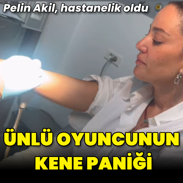 Koluna kene yapıştı