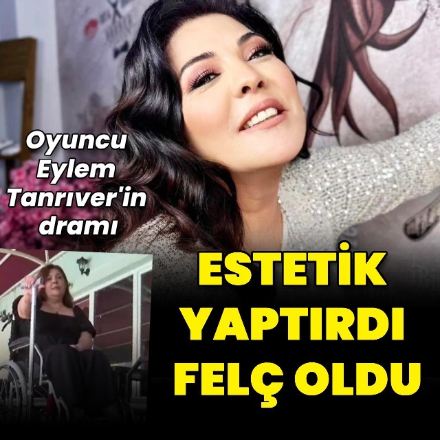 Estetik yaptırdı, felç oldu