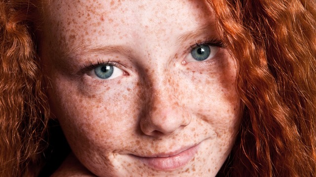 Kızıl saç ve mavi göz nasıl mümkün oluyor?