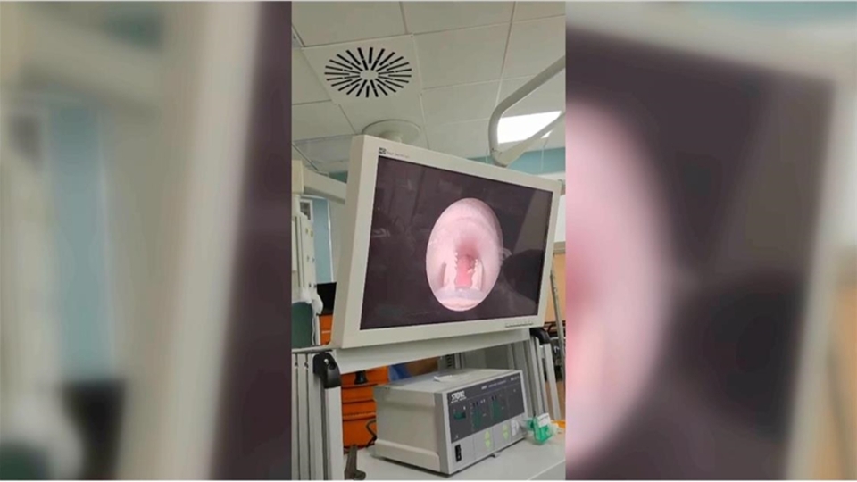 Yutkunamıyordu! Yemek borusundan et parçası çıktı