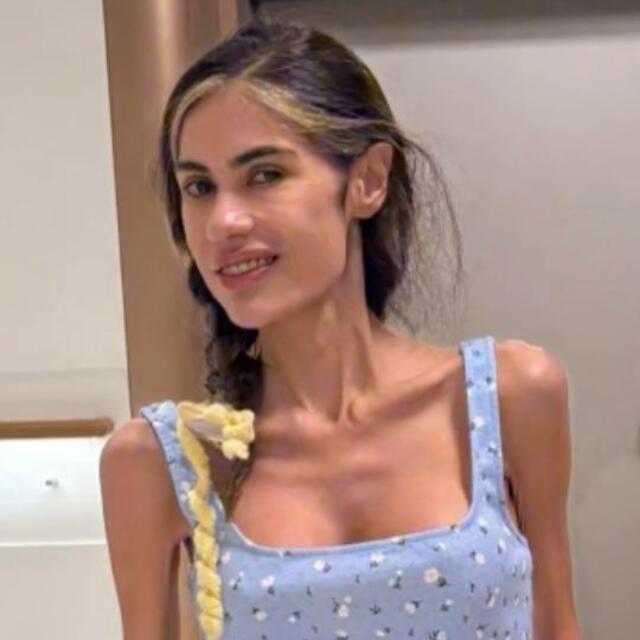 Bir deri bir kemik kaldı