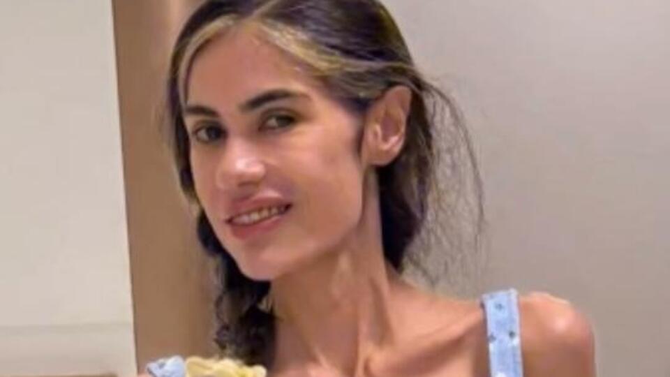 Bir deri bir kemik kaldı