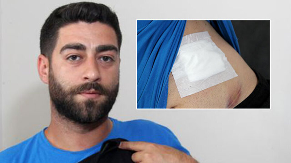 Karnında ağrı hissetti! Baktığında kan gördü! Gerçek röntgende belli oldu!