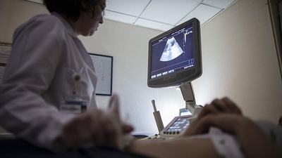 Çocukluk travması olanların çikolata kistine yakalanma riski daha fazla olabilir