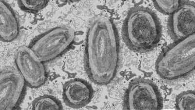 Gana'da 34 M-çiçeği vakası tespit edildi