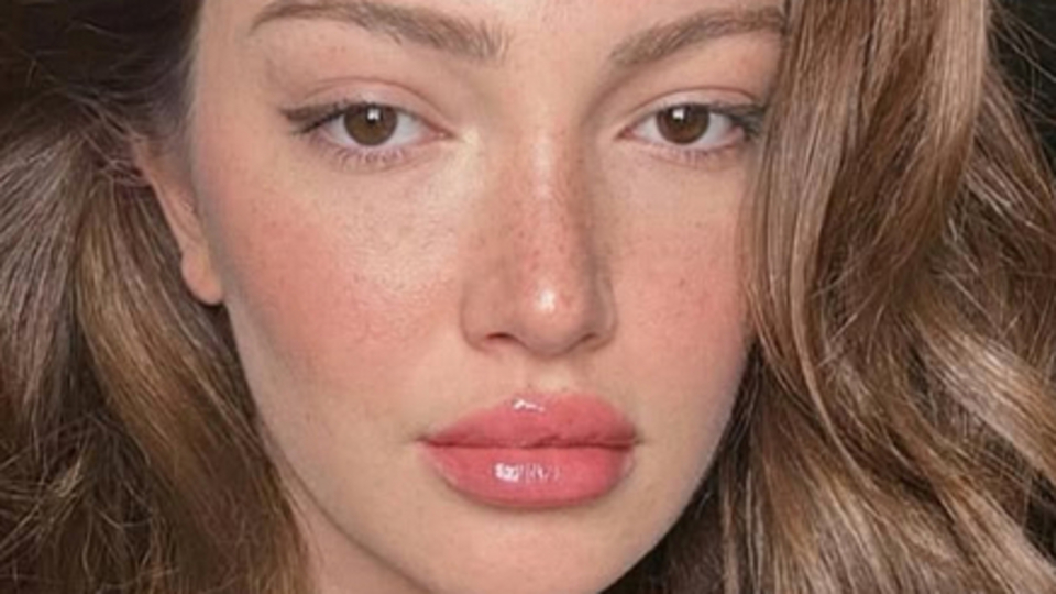 Estetik ameliyatlara servet harcadı