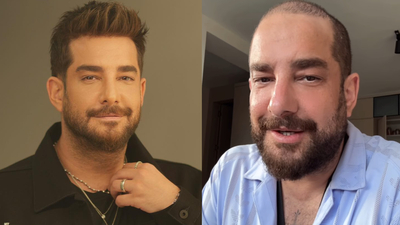 Protez saçını çıkardı