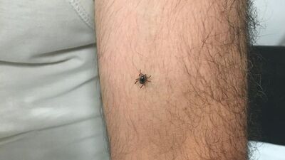 Bir ilçede daha kene vakası görüldü