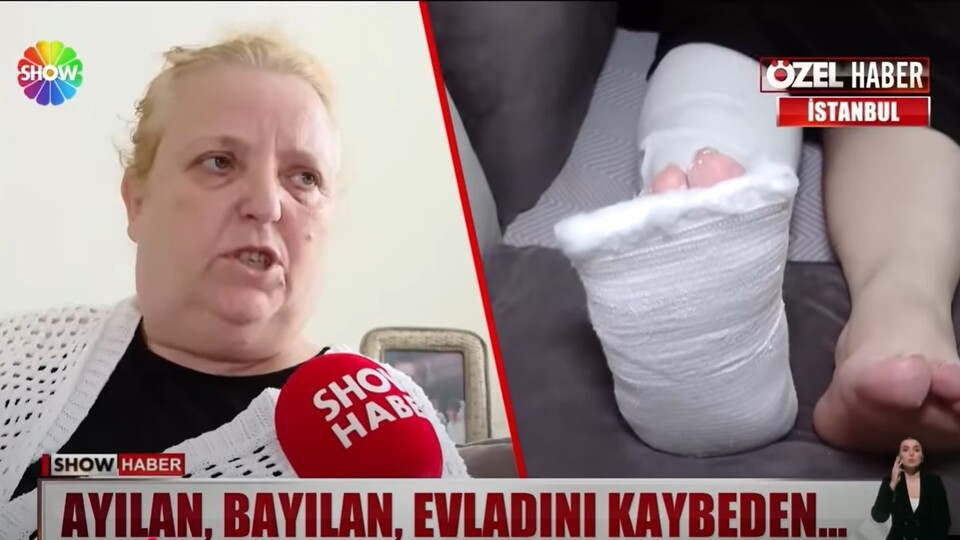 İzdihamda parmakları kırılan kadın Show Haber'e konuştu