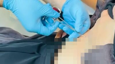 Halsizlik şikayetiyle hastaneye gitti! Karnından kene çıktı