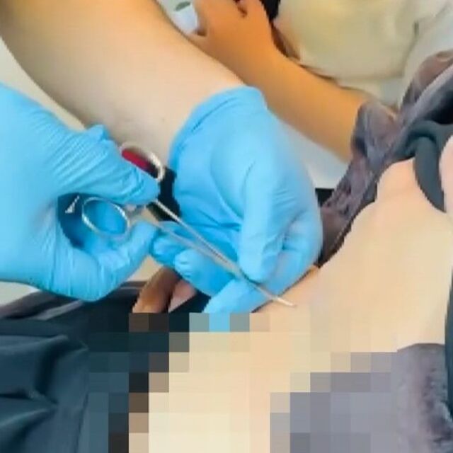 Halsizlik şikayetiyle hastaneye gitti! Karnından kene çıktı