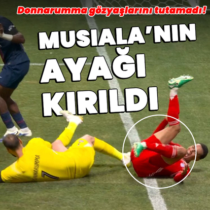 Musiala'nın ayağı kırıldı!