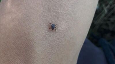 Keneye karşı 'dışarıda uyumayın' uyarısı!