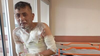 Bunun adı işkence!