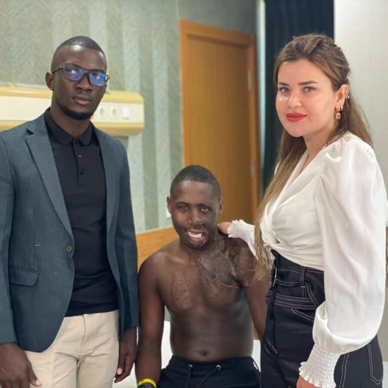Yüzü yanan Ugandalı çobana Ankara'da tedavi
