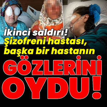 Şizofreni hastası, başka bir hastanın gözlerini oydu