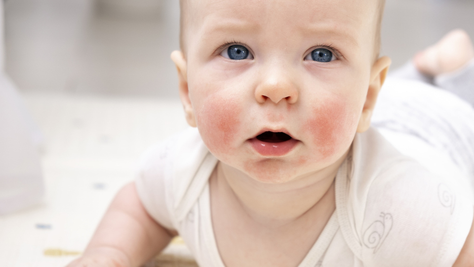 Yazın bebekleri isilikten korumanın yolları