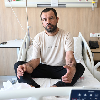 Uzuvlarını kaybedecekti! Doku nakliyle 5 ay sonra ayağa kalktı