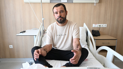 Uzuvlarını kaybedecekti! Doku nakliyle 5 ay sonra ayağa kalktı