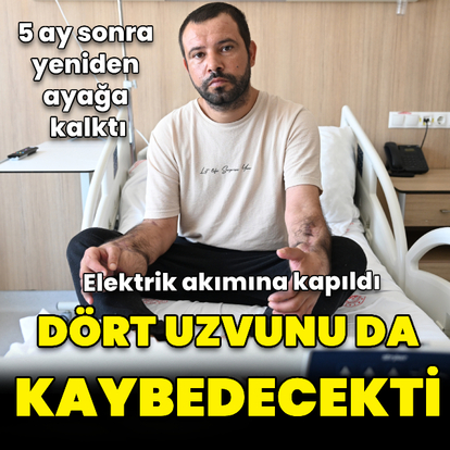 Uzuvlarını kaybedecekti! Doku nakliyle 5 ay sonra ayağa kalktı