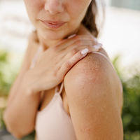 Güneş lekeleriyle vedalaşmanın yolları