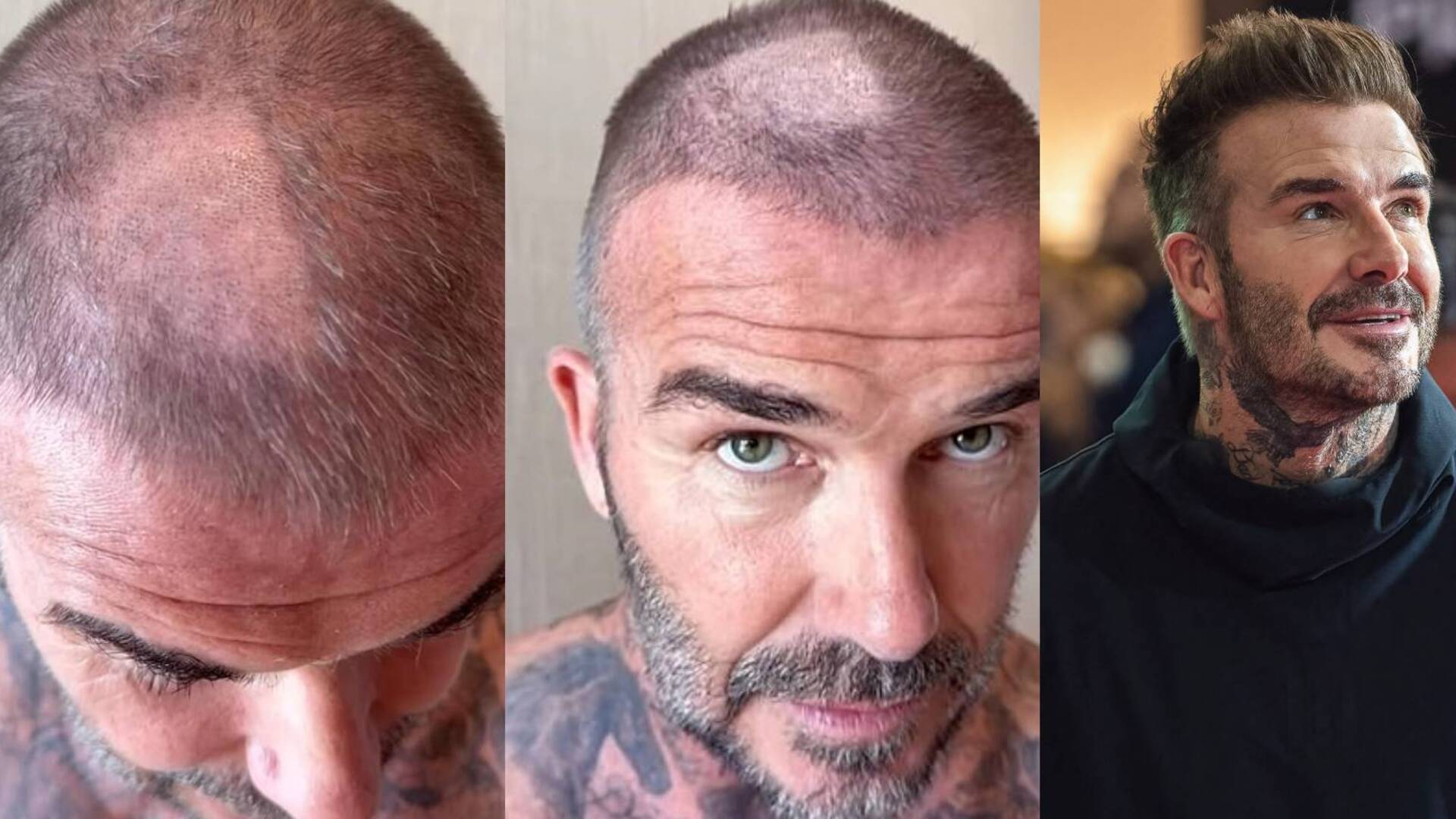 David Beckham'ın Şaşırtan Trafik Kazası: Ünlü Yıldızın Başına Gelenler!