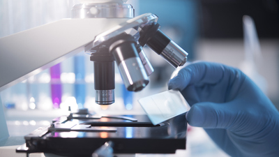 Mikroskobu kim icat etti?