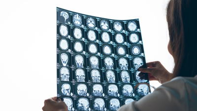 Araştırma: Covid-19 beyni yaşlandırdı