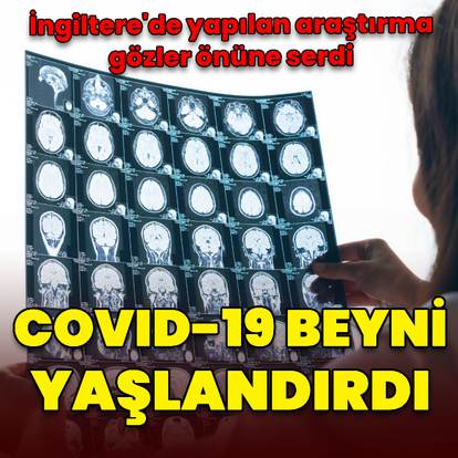 Araştırma: Covid-19 beyni yaşlandırdı