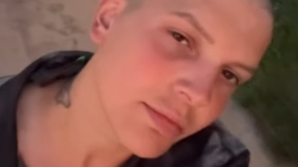 Saçlarını kazıttı