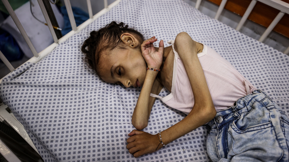 İsrail'in kıtlığa sürüklediği Gazze'de insanlık dramı yaşanıyor