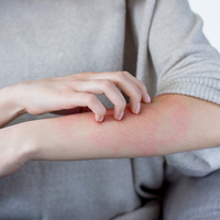 Kaşıntıyı hafifletmenin doğal yolları