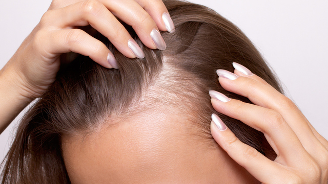 Mevsimsel dökülme mi, kalıcı sorun mu?