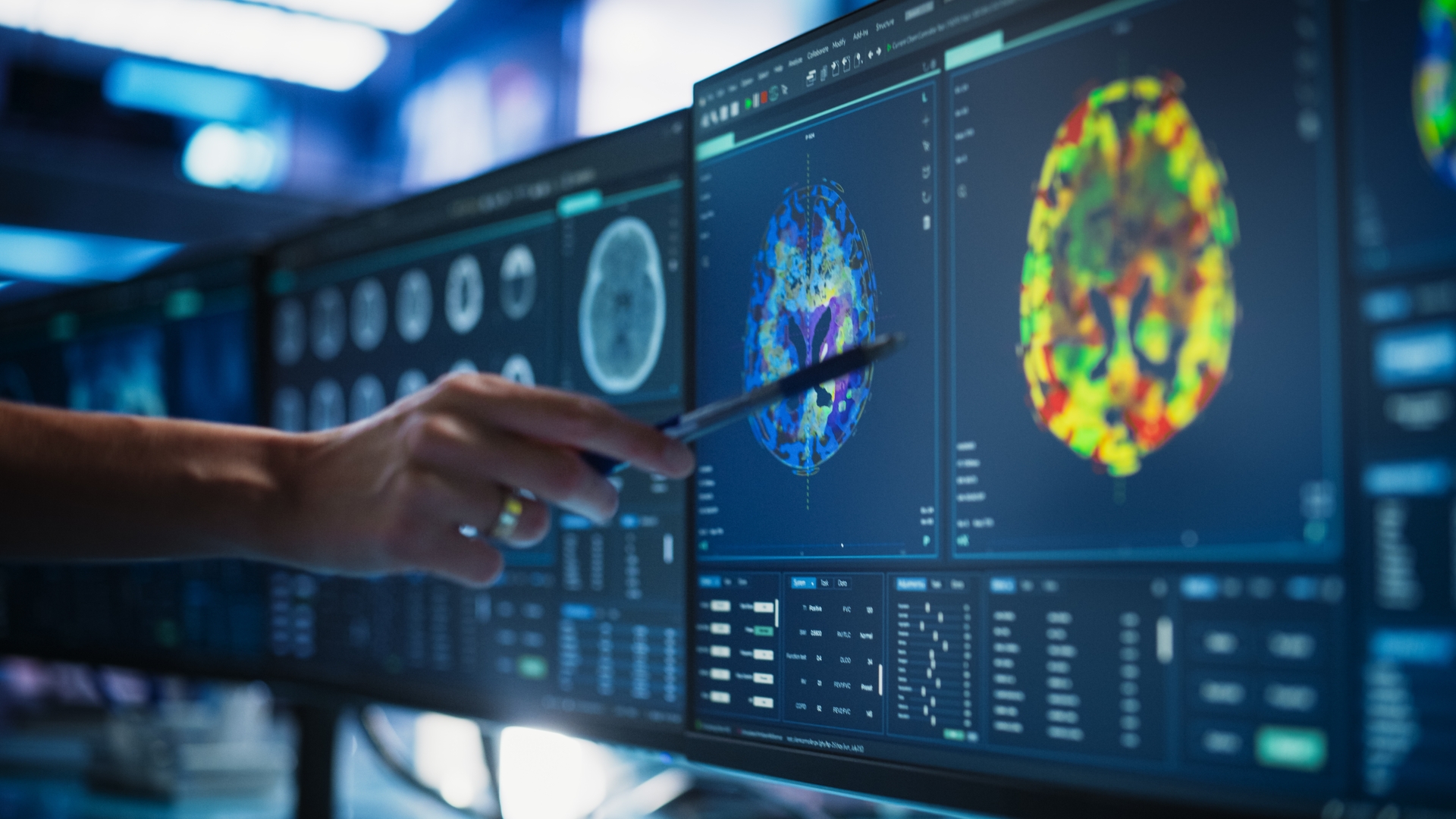 Alzheimer Tedavisinde Lityum Mucizesi: Bilim Dünyasını Heyecanlandıran Gelişme!
