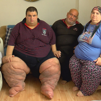 270 kiloya ulaştı! "15 aydır evden çıkamıyorum, yardım edin"