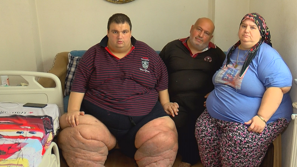 270 kiloya ulaştı! "15 aydır evden çıkamıyorum, yardım edin"