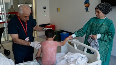 Güneşte 4 saat kaldı! 2. derece yanıkla hastanelik oldu