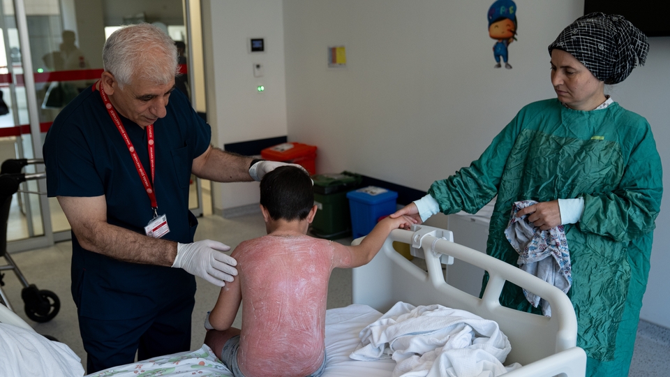 Güneşte 4 saat kaldı! 2. derece yanıkla hastanelik oldu