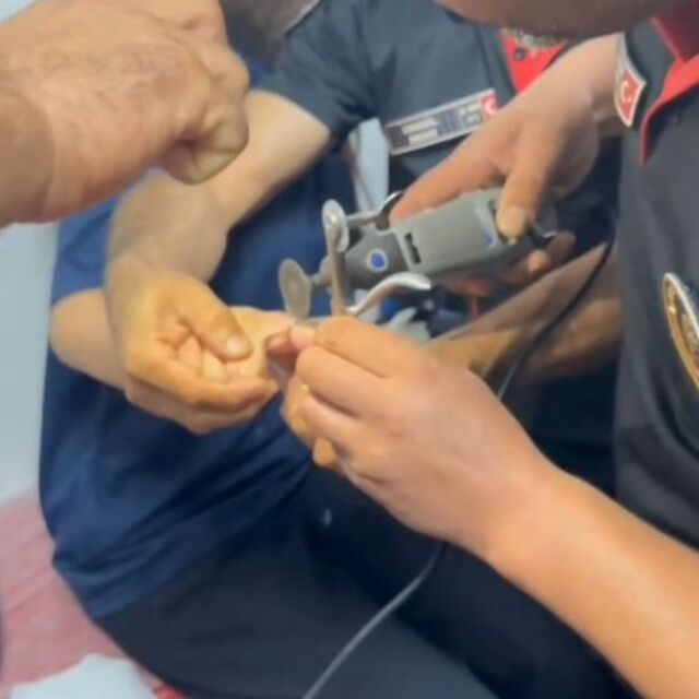 Genç kızın parmağında yüzük sıkıştı
