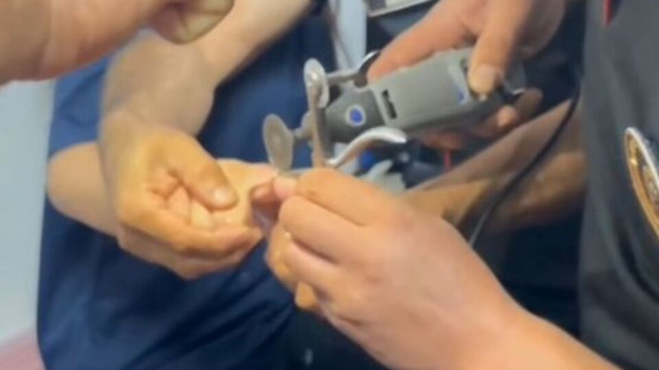 Genç kızın parmağında yüzük sıkıştı