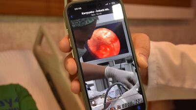 Akciğerinden diş implantı çıktı