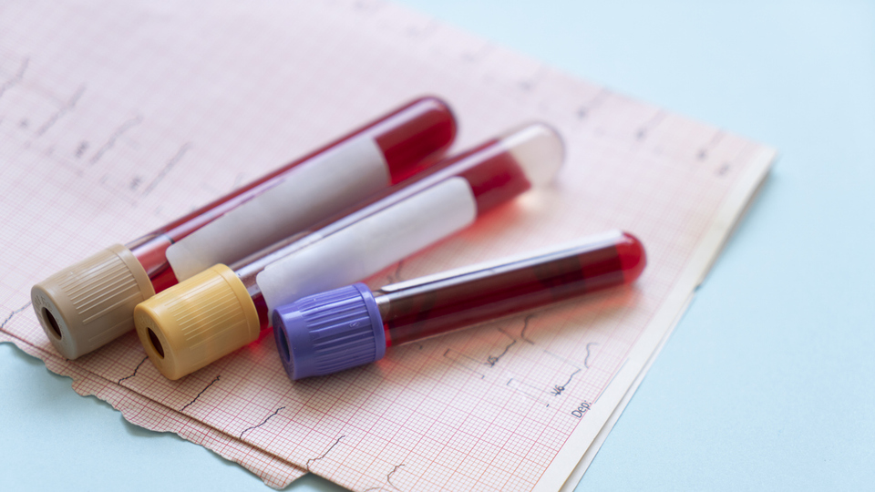 Üç tüp kan ver, hayat kurtar